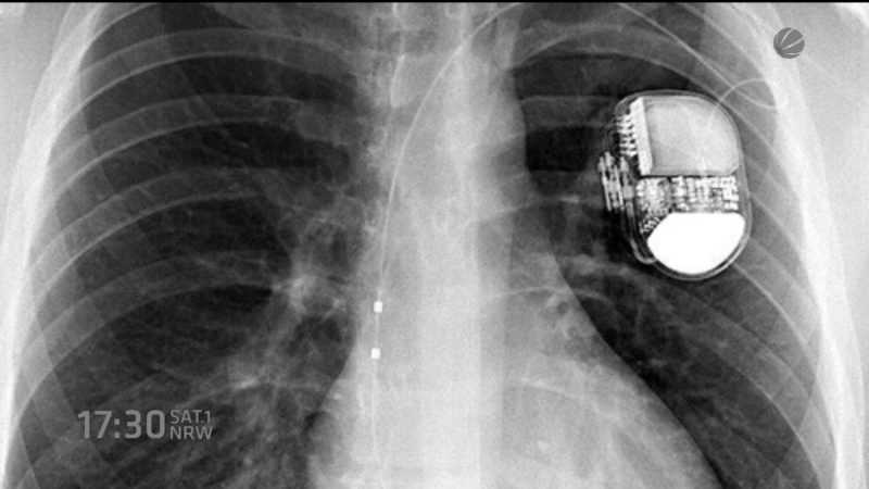 Kicker mit Defibrilator (Foto: SAT.1 NRW)