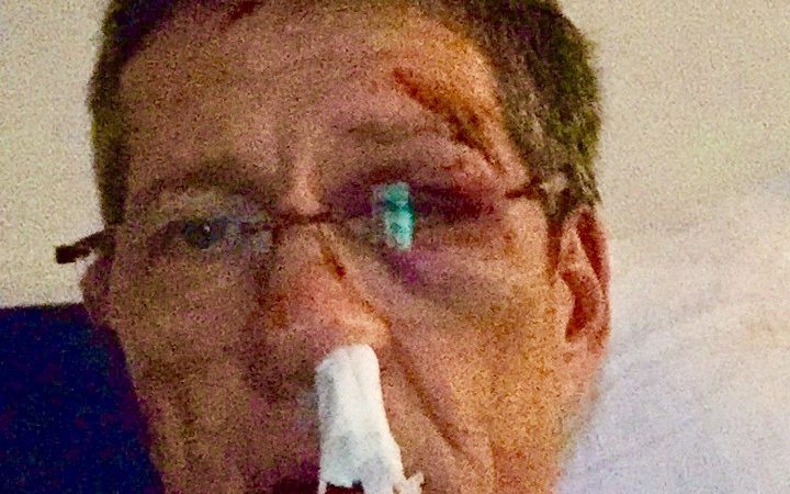 Arzt mit Baseballschläger fast totgeprügelt (Foto: SAT.1 NRW)