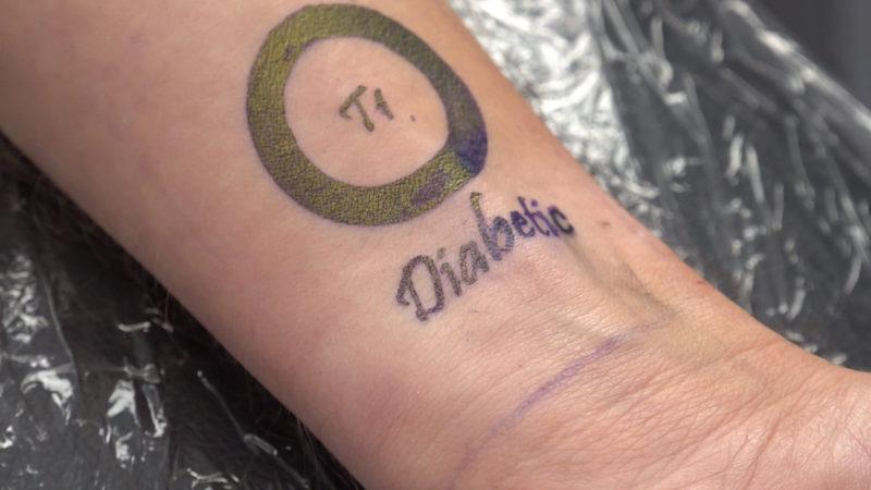 Diabetes-Tattoo soll Leben retten (Foto: SAT.1 NRW)