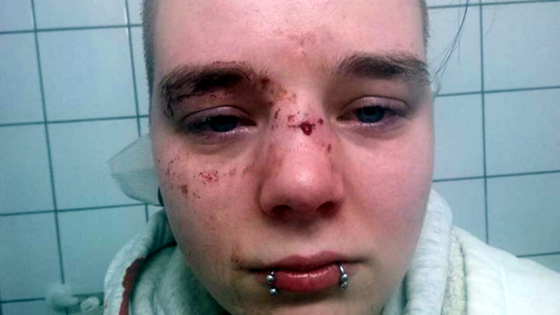 Jugendbande attackiert junge Frau (Foto: SAT.1 NRW)