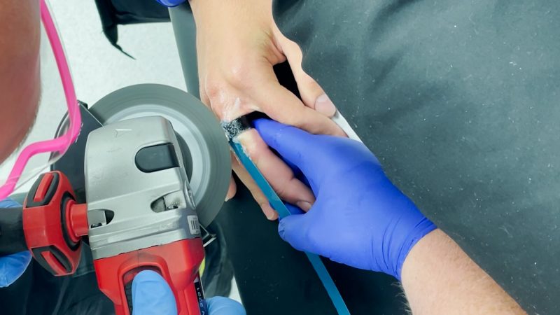 Dicker Finger wegen kleinem Ring  (Foto: SAT.1 NRW)